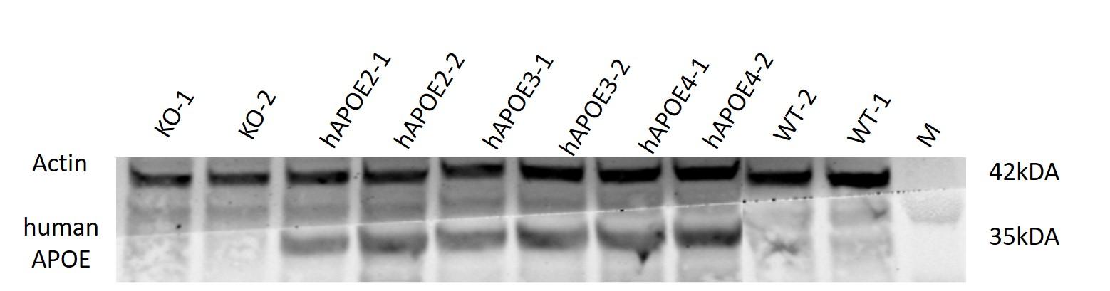 APOE3 Humanized Immune Checkpoint Mouse Model