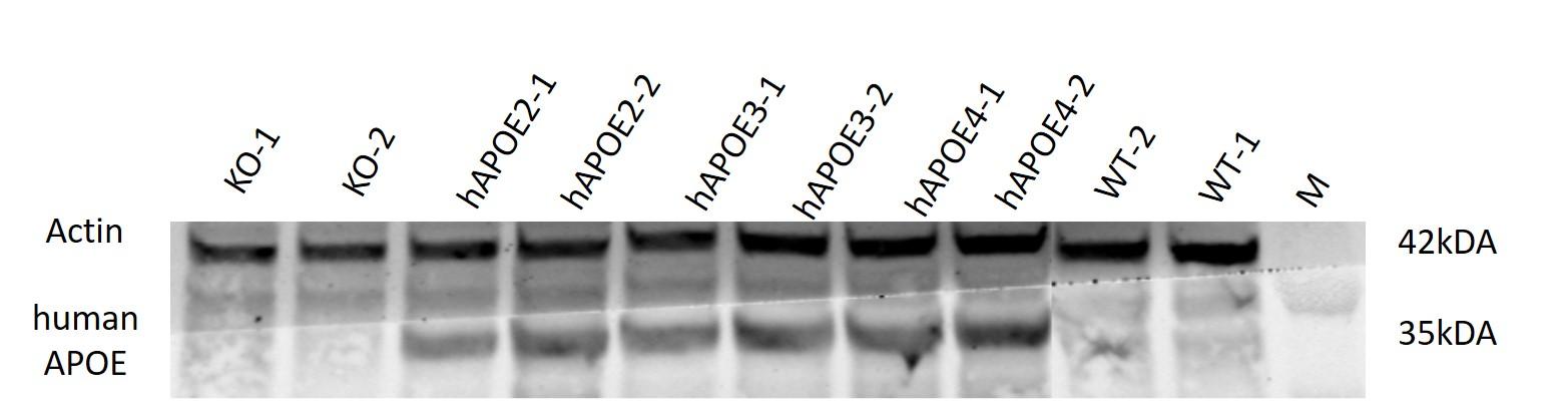 APOE4 Humanized Immune Checkpoint Mouse Model