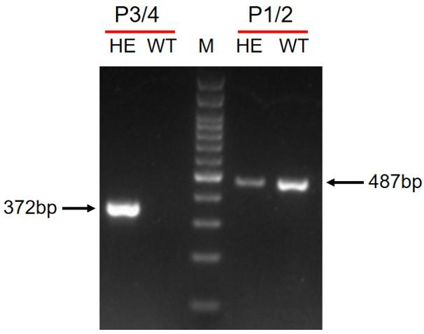 IL4RA Humanized Immune Checkpoint Mouse Model