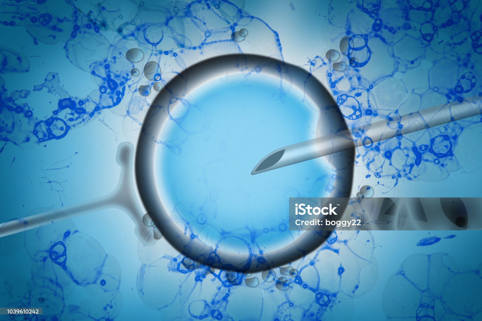 istockphoto-1039610242-2048x2048