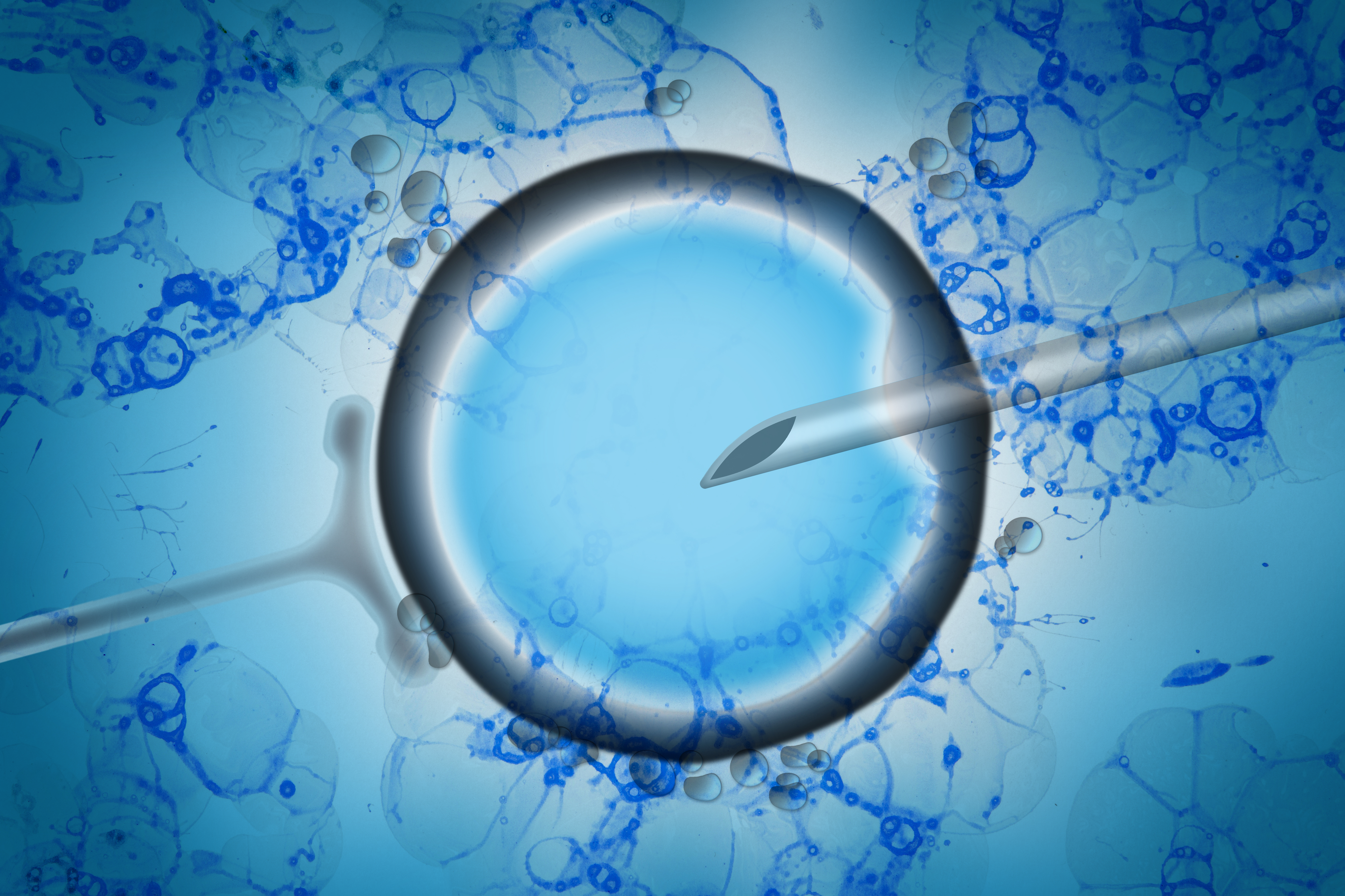 istockphoto-1039610242-2048x2048